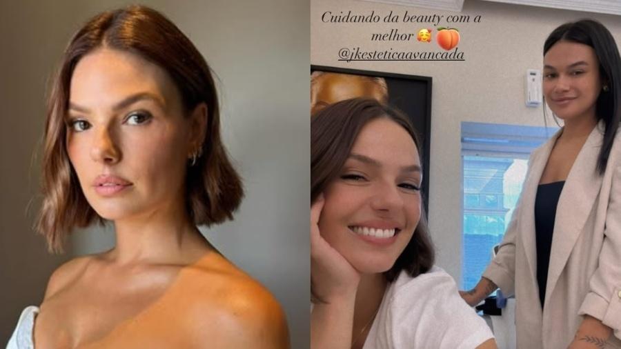 Isis Valverde faz procedimento no bumbum antes de lua de mel Isis Valverde faz procedimento no bumbum antes de lua de mel