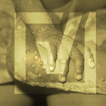 20.ago.2024 - Mpox volta a ser considerada emergência de saúde pública internacional e publicações nas redes sociais disseminam desinformação sobre o tema. 20.ago.2024 - Mpox volta a ser considerada emergência de saúde pública internacional e publicações nas redes sociais disseminam desinformação sobre o tema.